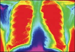 The Respiratory System