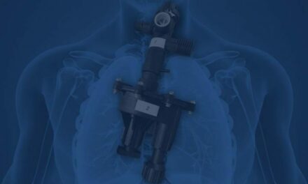 Researchers Detail RapidVent Emergency Ventilator Production