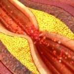 Boston Scientific to Acquire Bolt Medical