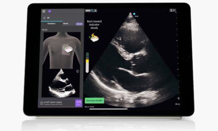 Caption AI Generates Real-Time Assessments for Vscan Air SL