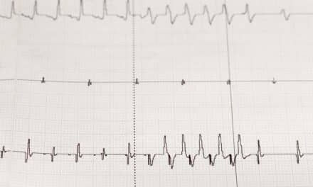 Qardio Launches Remote Patient Monitoring System That Includes Cardiac Monitoring Service