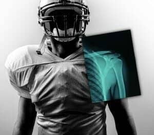 NFL Deploys Carestream Digital X-ray Technology