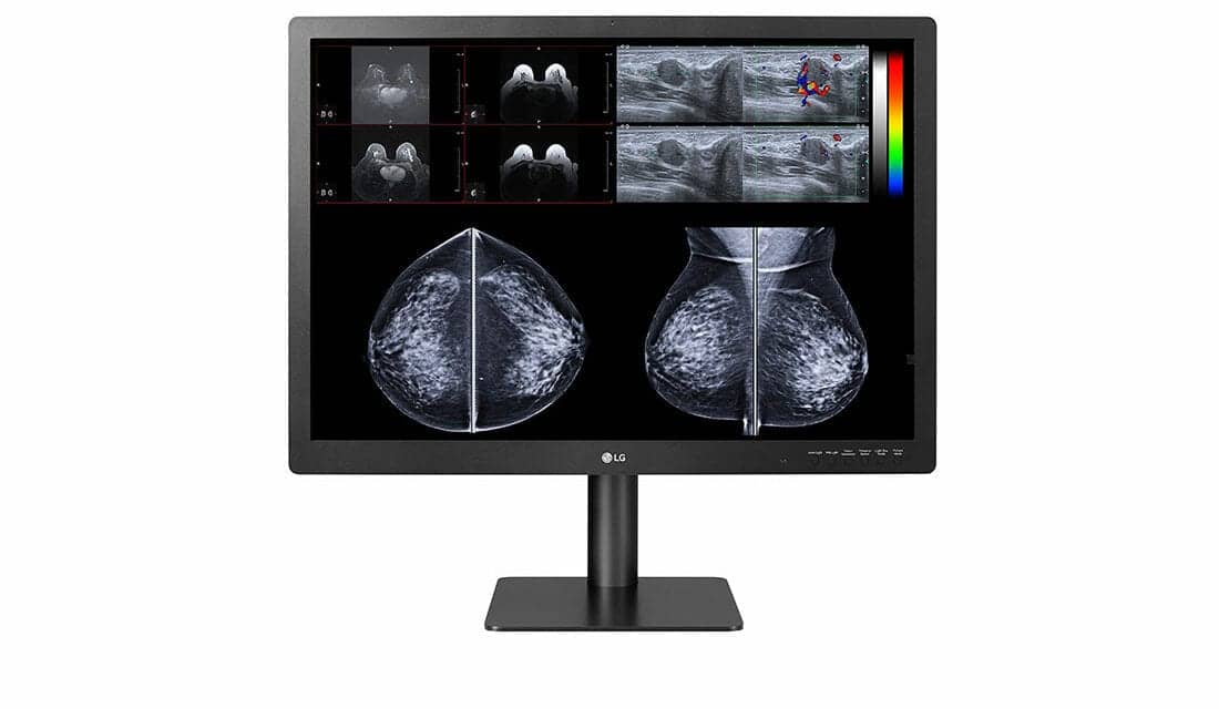 LG Unveils New 12-Megapixel Multimodality Display