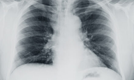 Imidex VisiRad XR Receives FDA Clearance