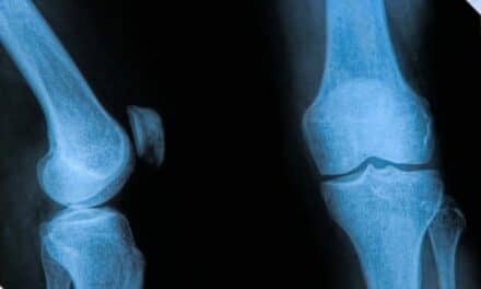 Report: Refurbished Orthopedic Medical Imaging Market Hotter Than Ever