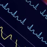 Turning the Corner on Clinical Alarms