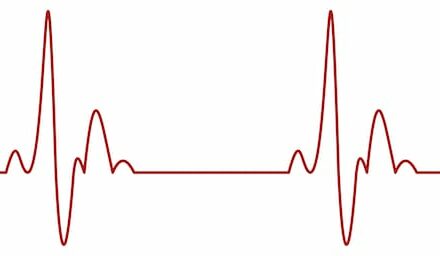 Stroke, Heart Failure Cited in Cardiovascular Monitoring Market Growth