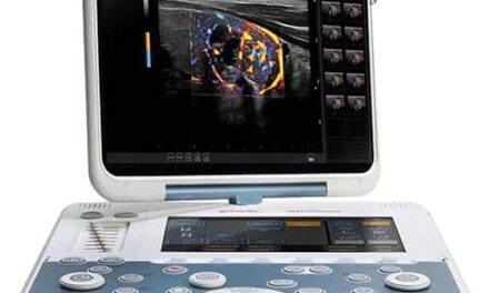 Portable Ultrasound System