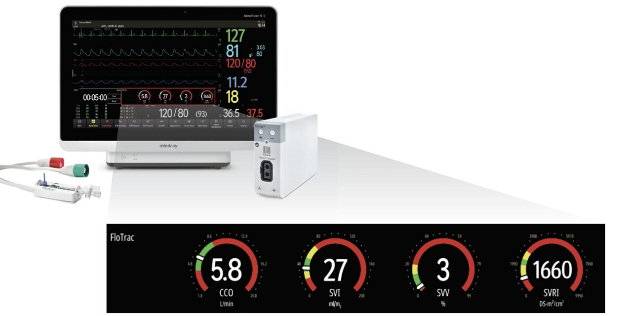 Mindray Announces New Integration with Edwards FloTrac Sensor