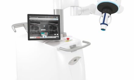 High-Intensity Focused Ultrasound Shows Promise for Graves’ Disease Treatment