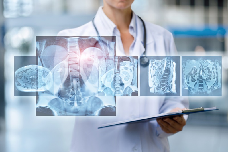 Getinge Partners With SurgicalOne on Fluorescence Technology