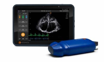 EchoNous & Samsung Create Alliance to Bolster AI-Guided Ultrasound Solutions