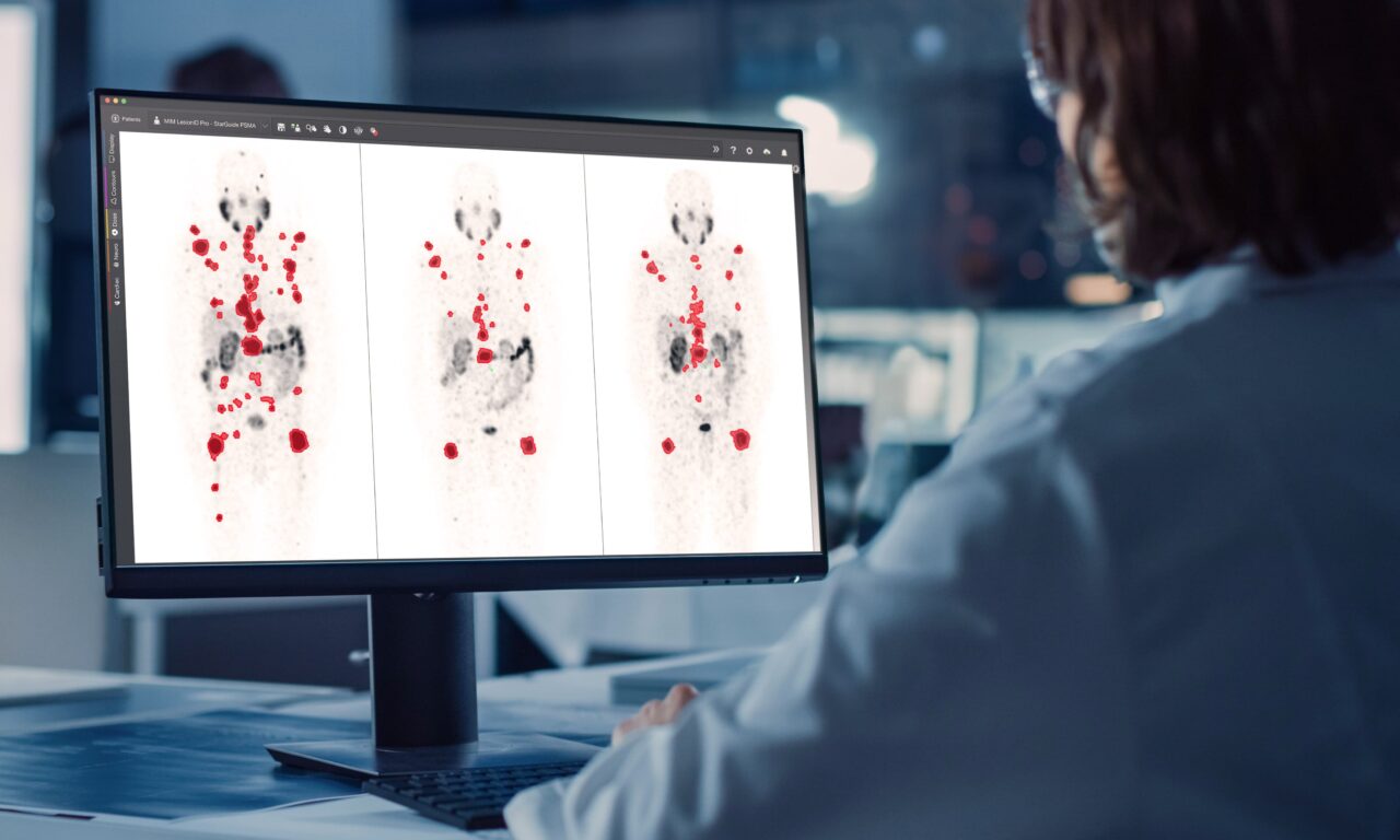 168JISU一分钟赛车官网结果号码 GE HealthCare Showcases Theranostics Portfolio and Imaging Advances at SNMMI 2025