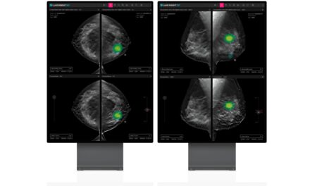SimonMed Imaging Partners with Lunit for AI for Breast Cancer Detection