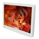 Ampronix Reintroduces Its Medvix Surgical Displays