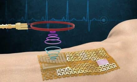 Engineers Fabricate a Chip-Free, Wireless Electronic ‘Skin’ Sensor
