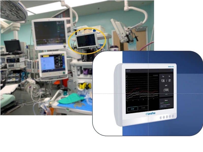Sensifree Gets CE Cert for Non-Invasive Blood Pressure Monitor