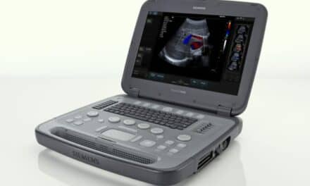 Siemens Portable Ultrasound System Handles High-volume Imaging