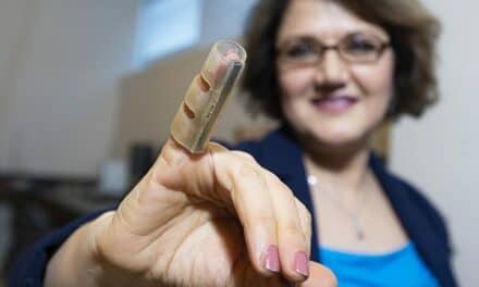 College Engineering Team Designs Finger Support to Correct Deformities