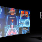 Unlock the Power of 4K in Surgery: IMAGE1 S™ System Insights