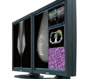 Color Diagnostic Display Earns 510(k) Approval for Digital Mammography