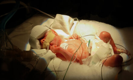 Researchers Study Ventilator Issues in Critically Ill Children