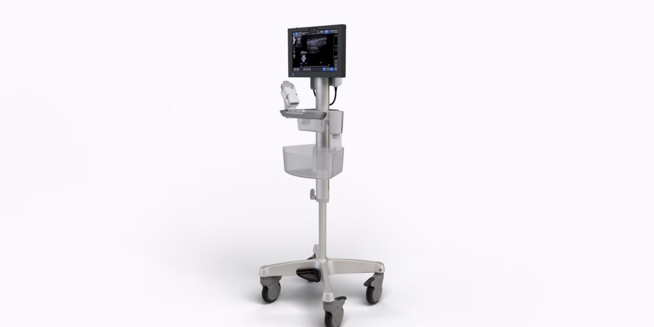 GE HealthCare Launches Venue Sprint Ultrasound System