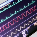 Tips for Testing Patient Monitors