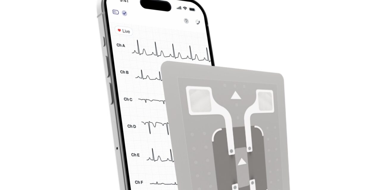 WearLinq Acquires AMI Cardiac Monitoring