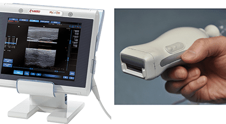 Handheld Probe Gives Clinicians New Imaging Capabilities