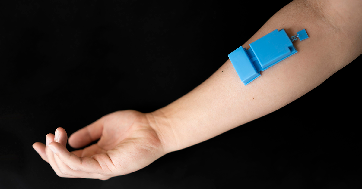 Wearable Ultrasound Enables Noninvasive Muscle Monitoring